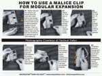 Клипсы MALICE 3", короткие, набор из 4 штук - Клипсы Malice короткие как вплетать.